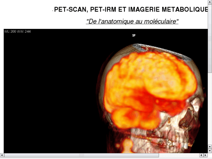 www.petscan.fr