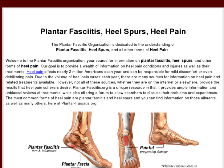 www.plantar-fasciitis.org