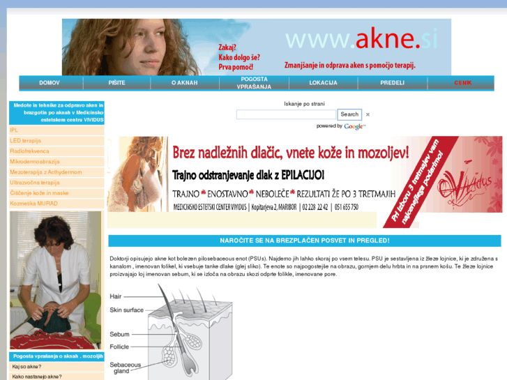 www.akne.si