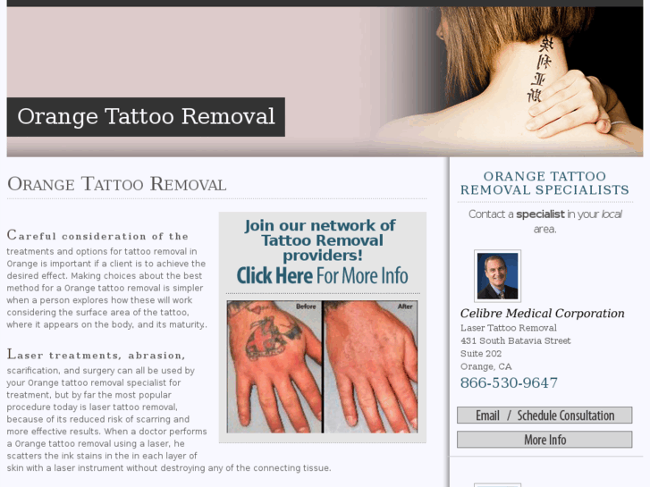 www.orangetattooremoval.com