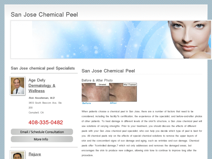 www.sanjosechemicalpeel.com