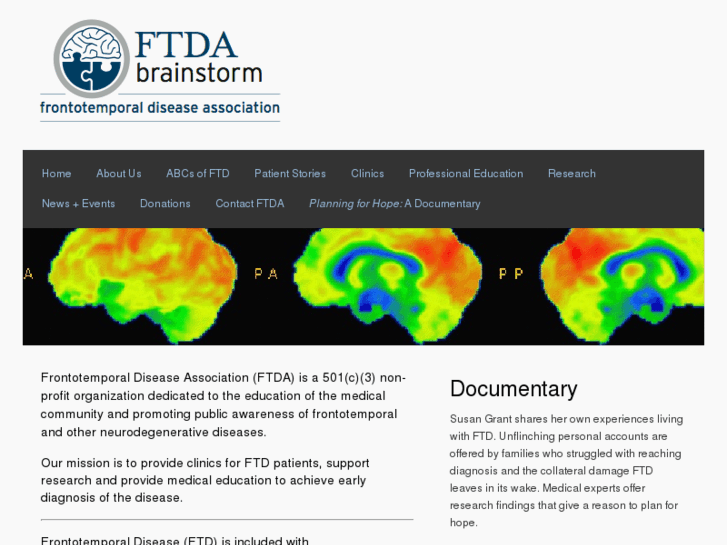 www.ftdabrainstorm.org