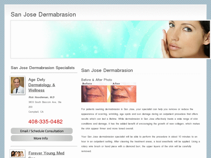 www.sanjosedermabrasion.com