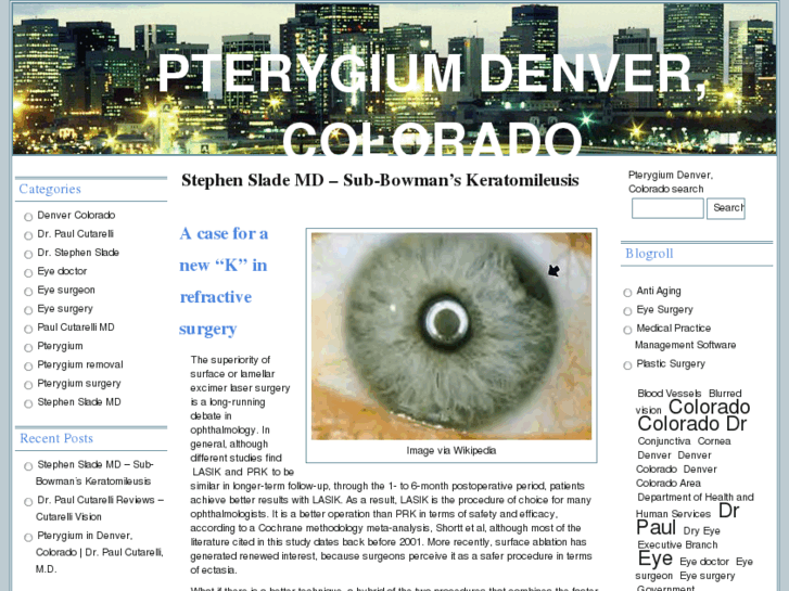 www.pterygium-eye.com