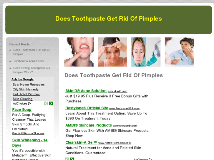 www.doestoothpastegetridofpimples.com