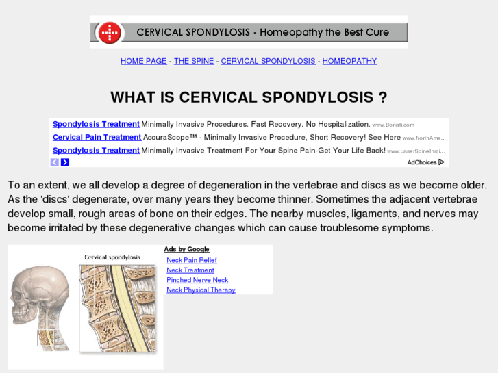 www.cervical-spondylosis.com