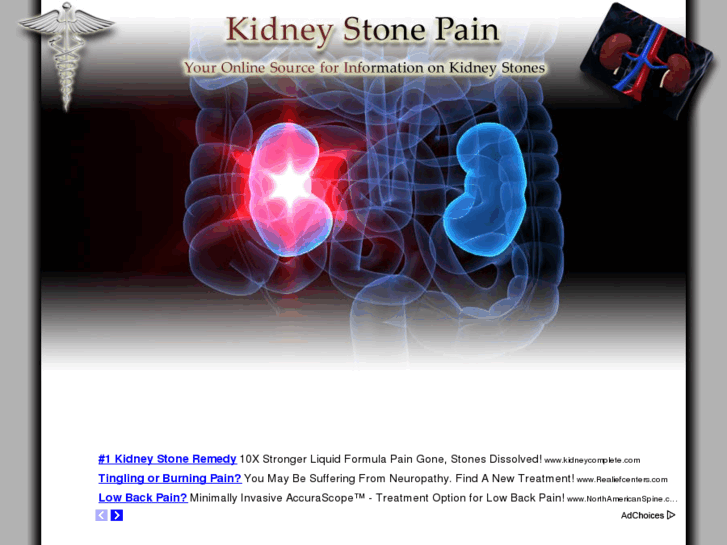 www.kidneystonepain.net