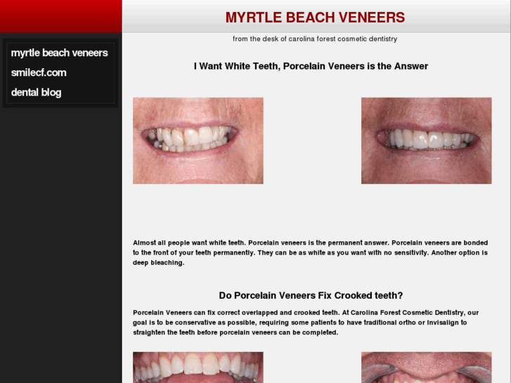 www.myrtlebeachveneers.com