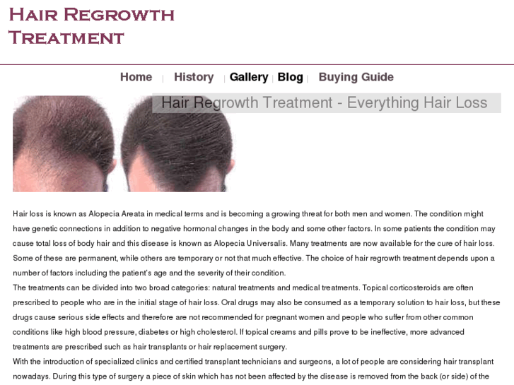 www.hairregrowthtreatment.org