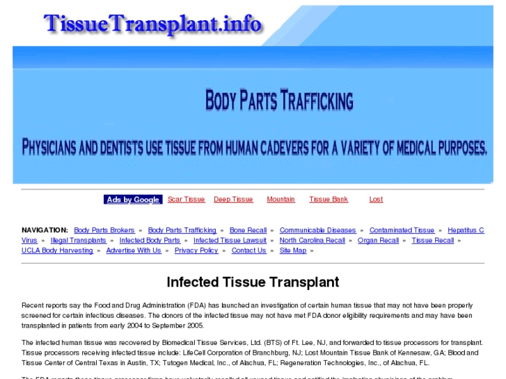 www.tissuetransplant.info