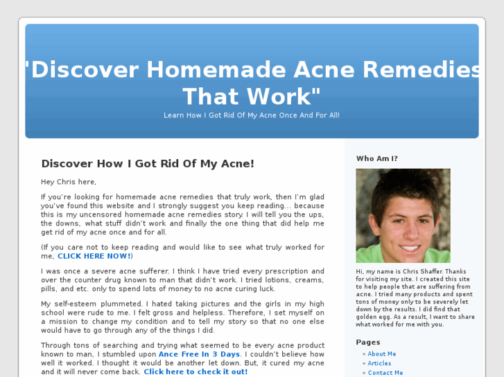 www.homemadeacneremedies.org