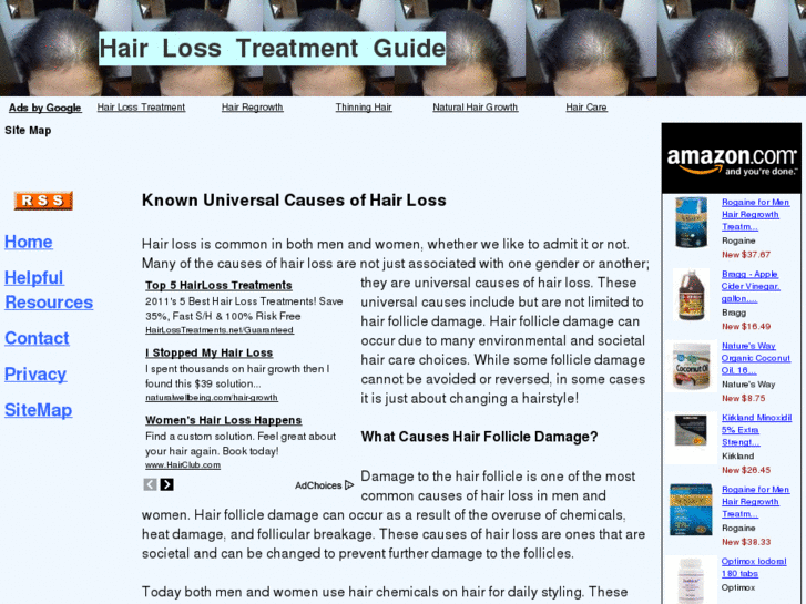 www.hairlosstreatment-guide.com