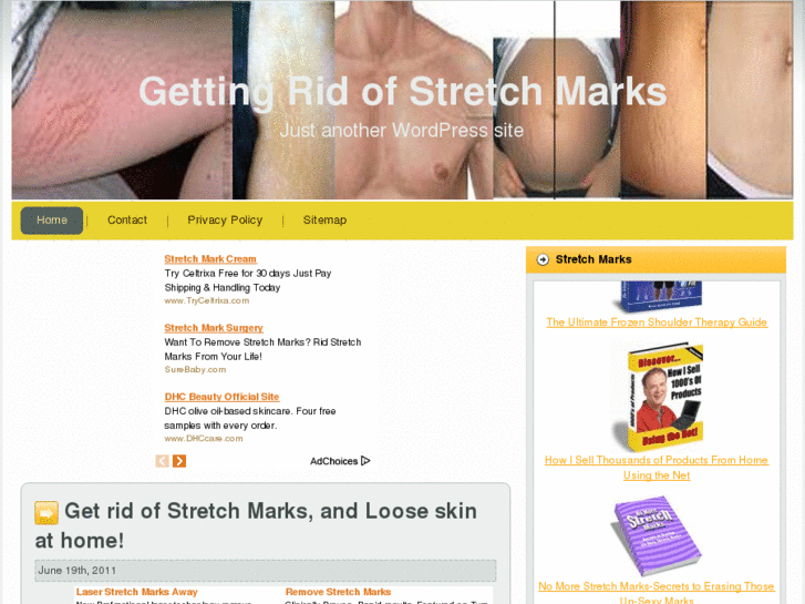 www.gettingridofstretchmarks.info