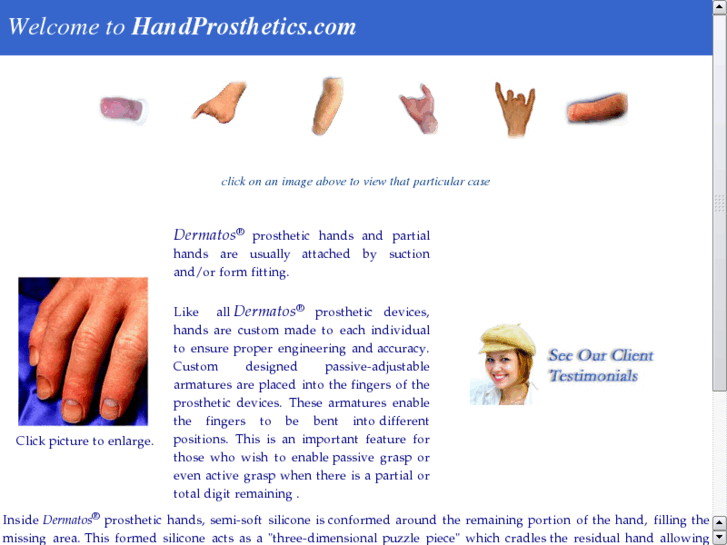 www.handprosthetics.com