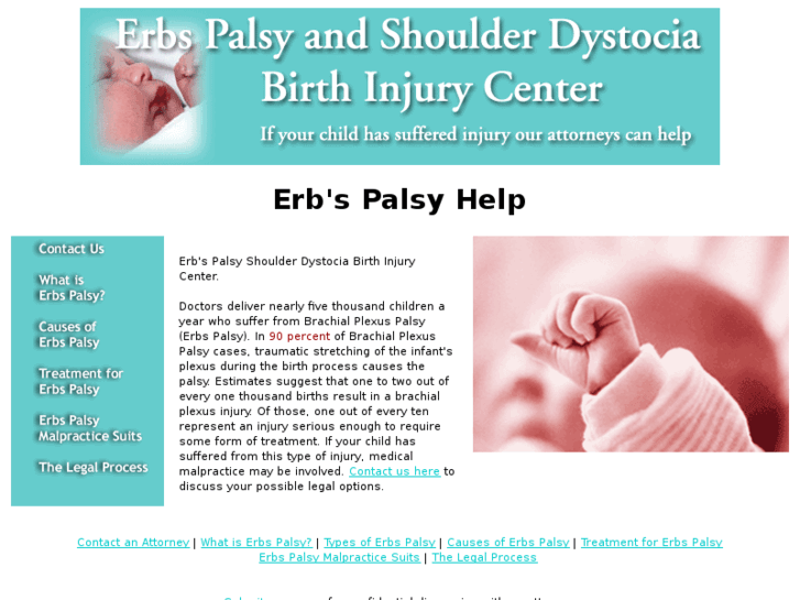 www.erbs-palsy-birth-injuries.com