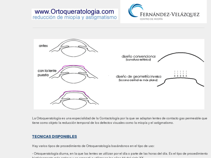 www.ortoqueratologia.com