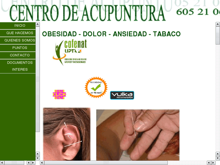 www.acupuntorbarcelona.es