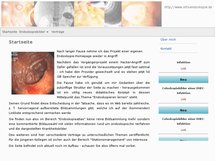 www.info-endoskopie.de