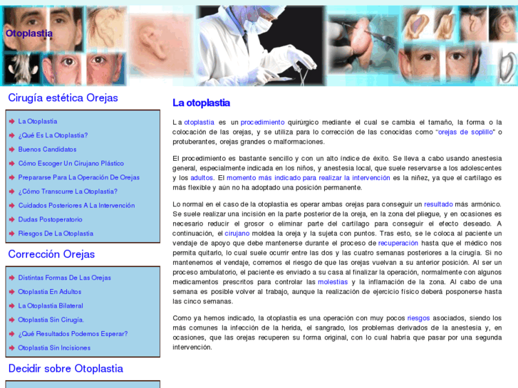 www.otoplastia.org.es