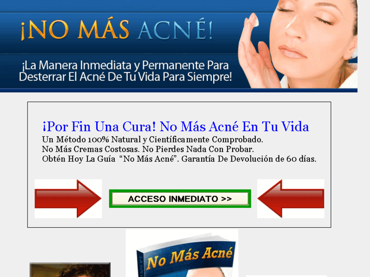 www.no-mas-acne.org