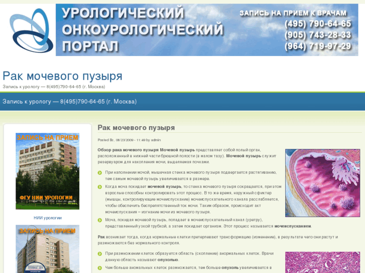 www.urinary-bladder-cancer.ru