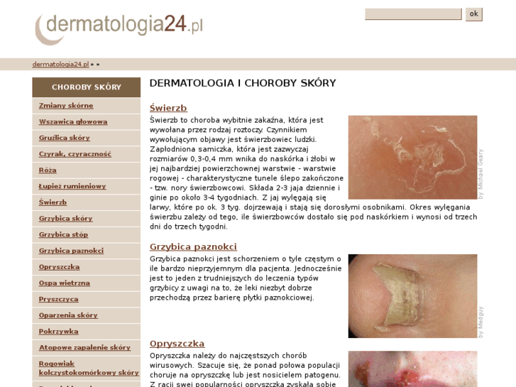 www.dermatologia24.pl