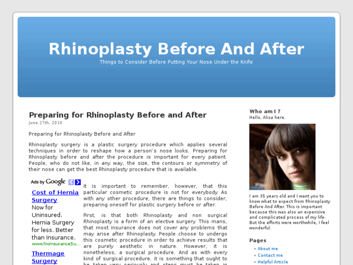 www.rhinoplastybeforeandafter.biz