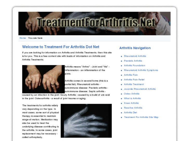 www.treatmentforarthritis.net