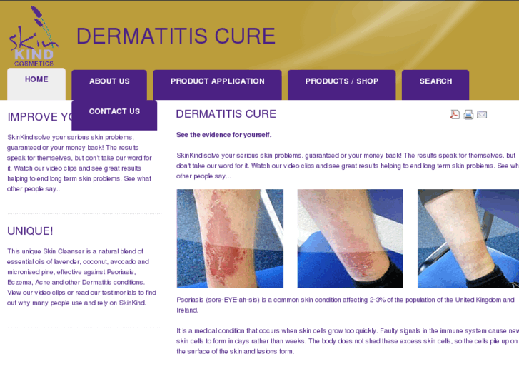 www.dermatitis-cure.com