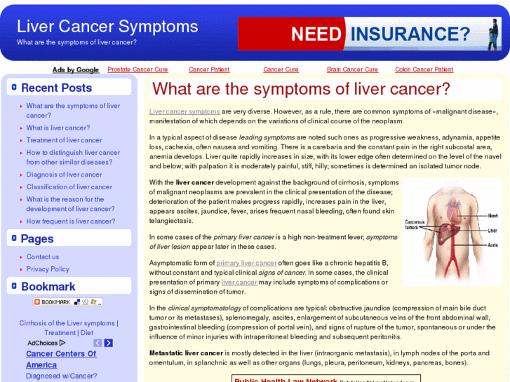 www.livercancersymptoms.net