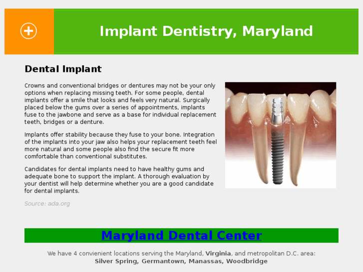 www.implantdentalmaryland.com