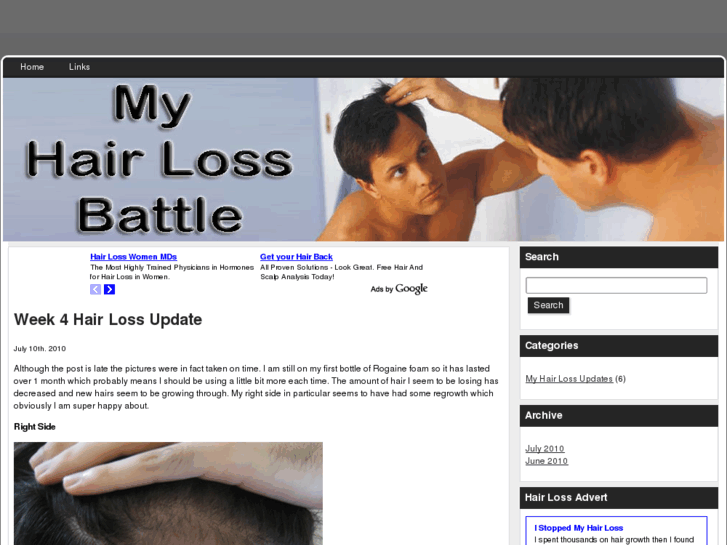 www.myhairlossbattle.com