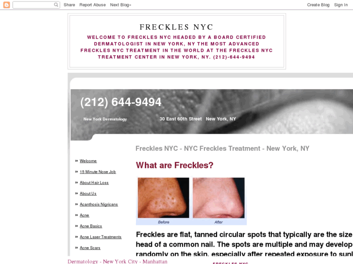 www.frecklesnyc.org