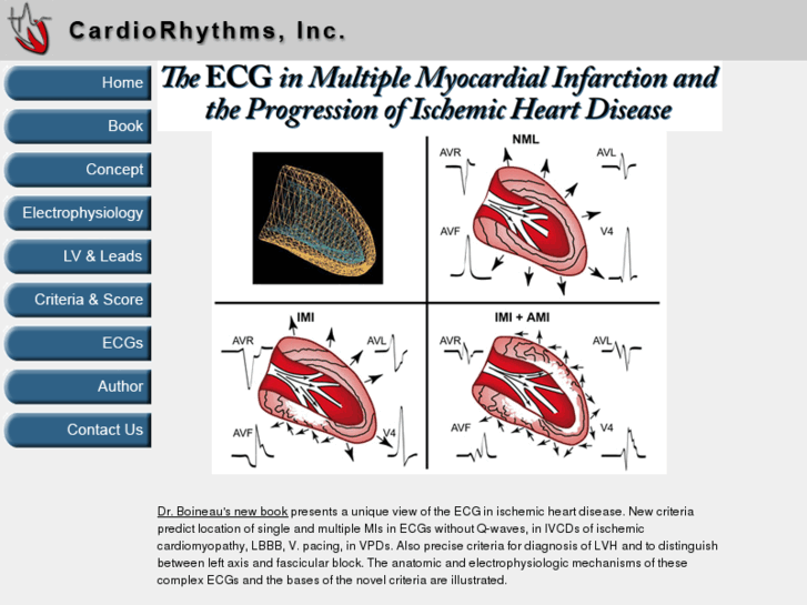 www.cardiorhythms.com