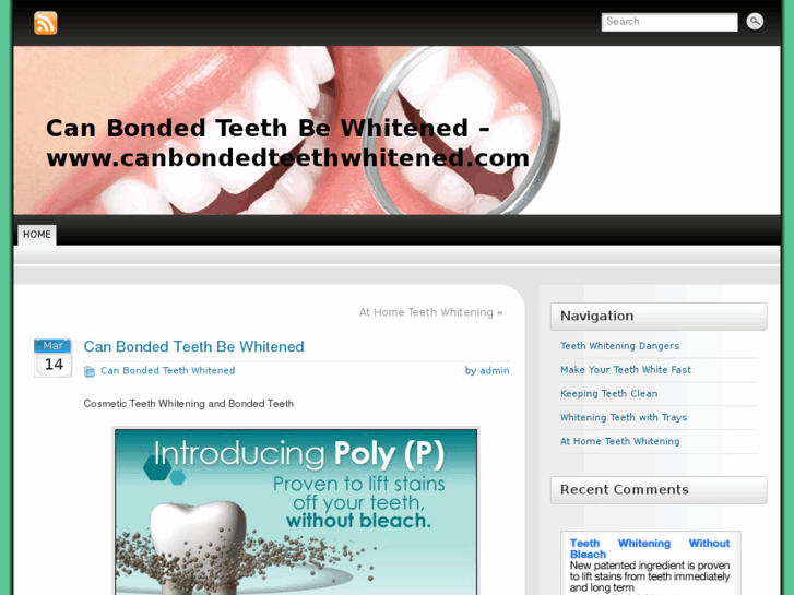 www.canbondedteethwhitened.com