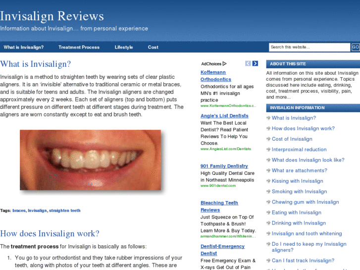 www.invisalign-reviews.com