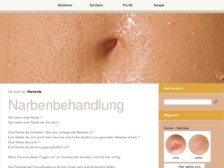 www.narbenbehandlung.info