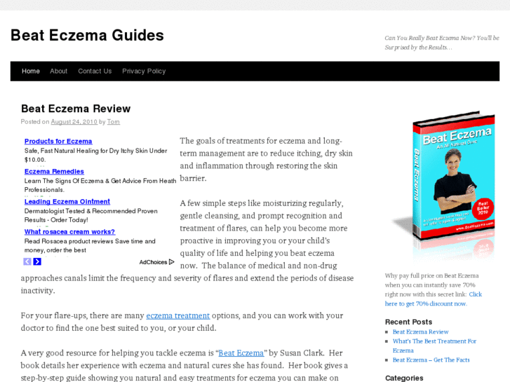 www.beateczemaguides.com