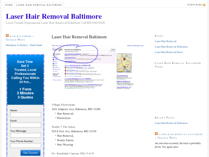 www.laserhairremovalbaltimore.net