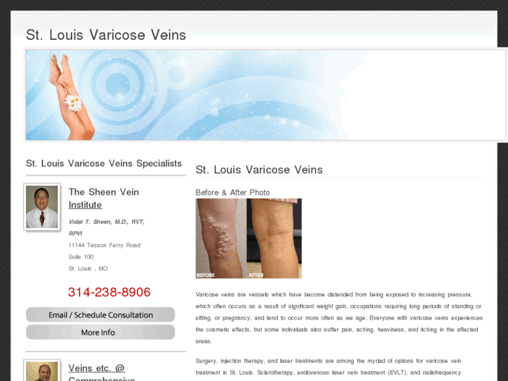 www.stlouisvaricoseveins.net