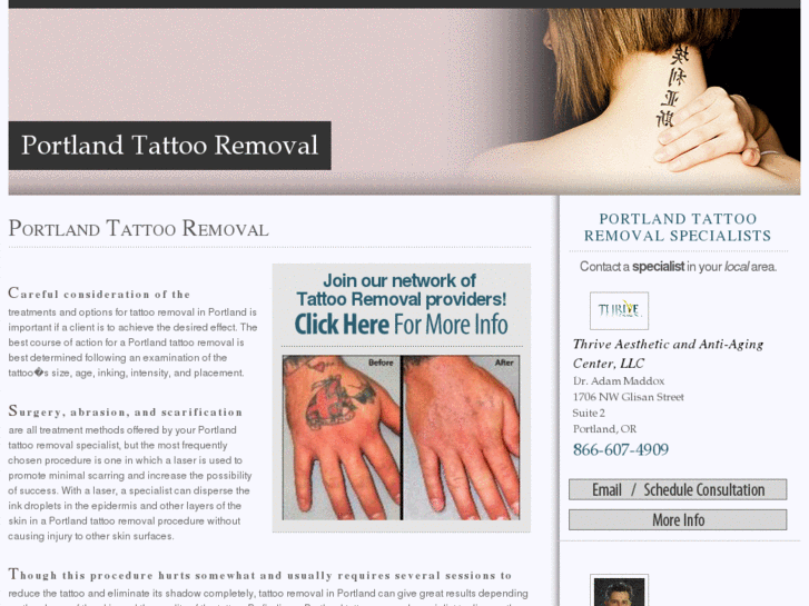 www.portlandtattooremoval.org