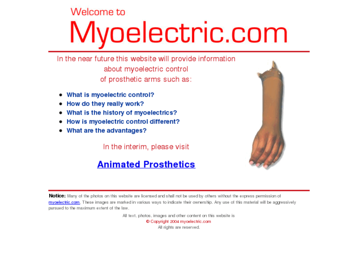 www.myoelectric.com