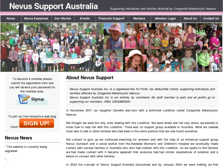 www.nevussupport.com