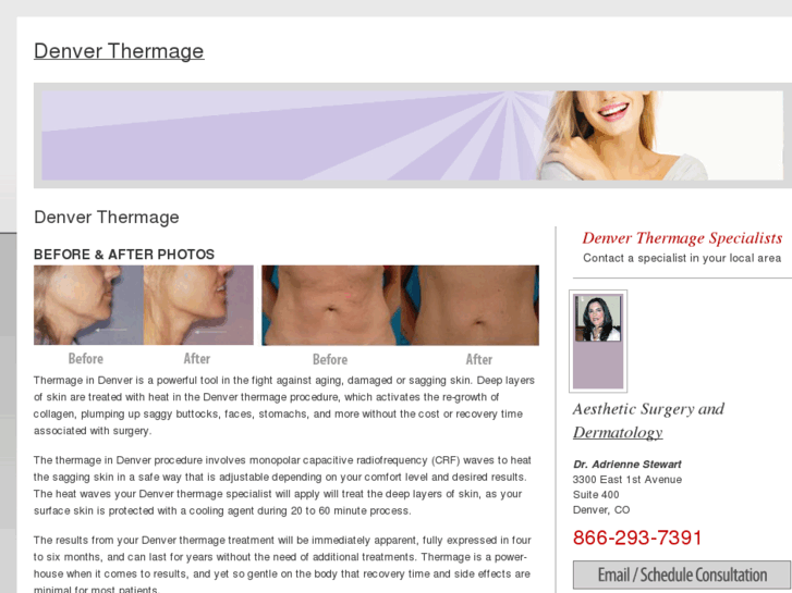 www.denverthermage.com