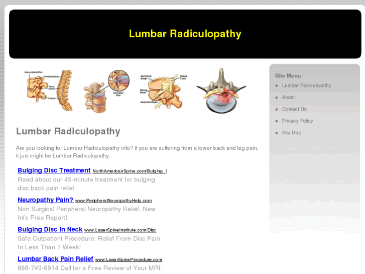 www.lumbarradiculopathy.net