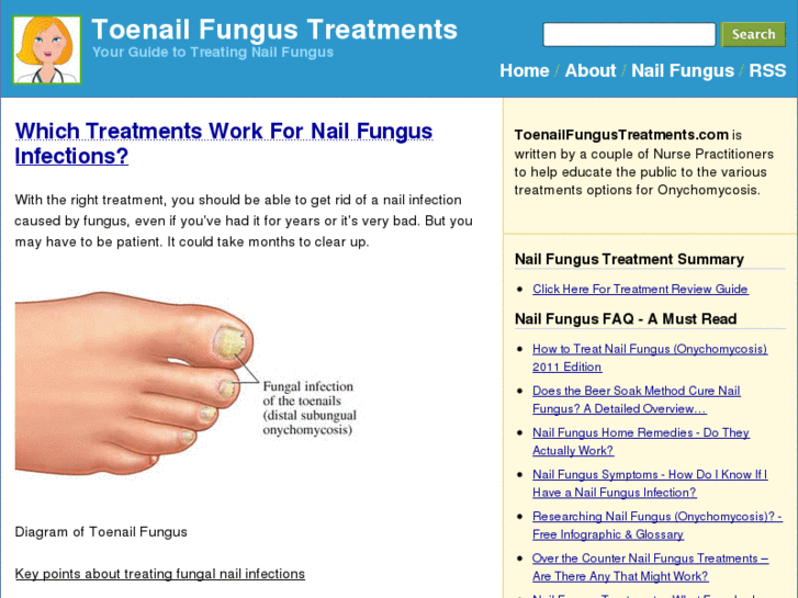 www.toenailfungustreatments.com