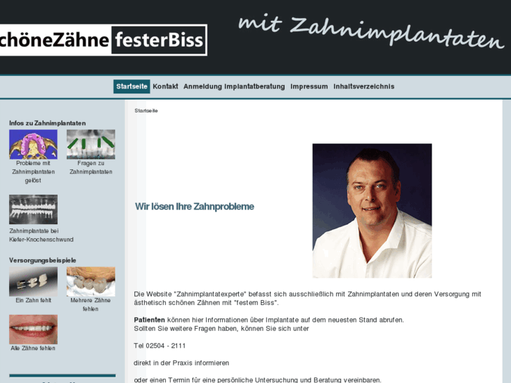 www.zahnimplantatexperte.de