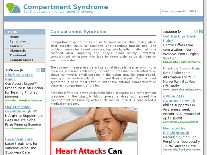 www.compartmentsyndrome.net