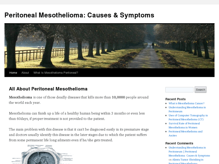 www.mesothelioma-peritoneal.com