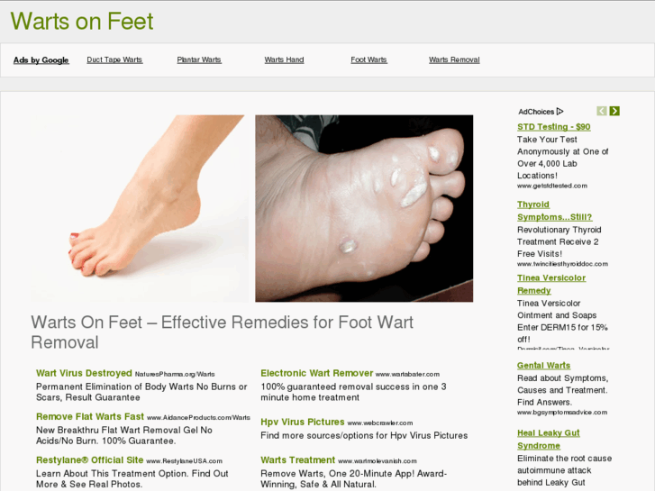 www.wartsonfeet.org